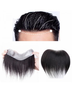 Trimmable Adhesive Hairline patch--BB002