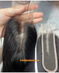 2*6 HD Lace Closure 
